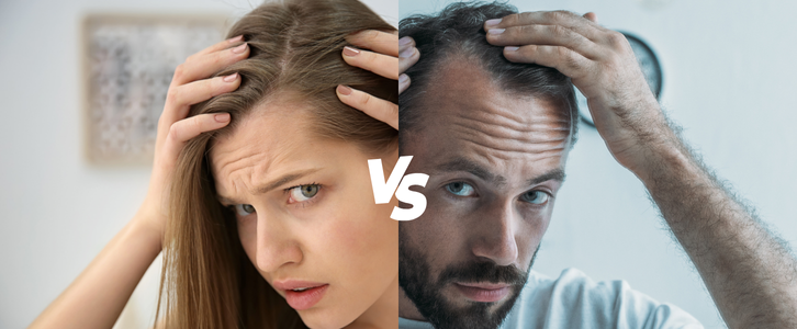 Men’s Hair Loss Treatments vs. Women’s Hair Loss Treatments: Key Differences