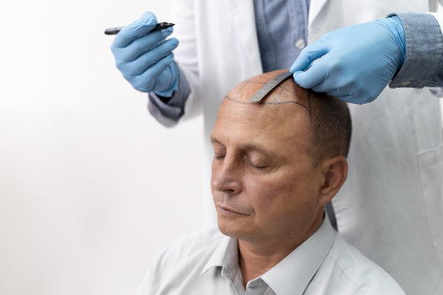 Comparing Laser Devices and Hair Transplants for Hair Loss