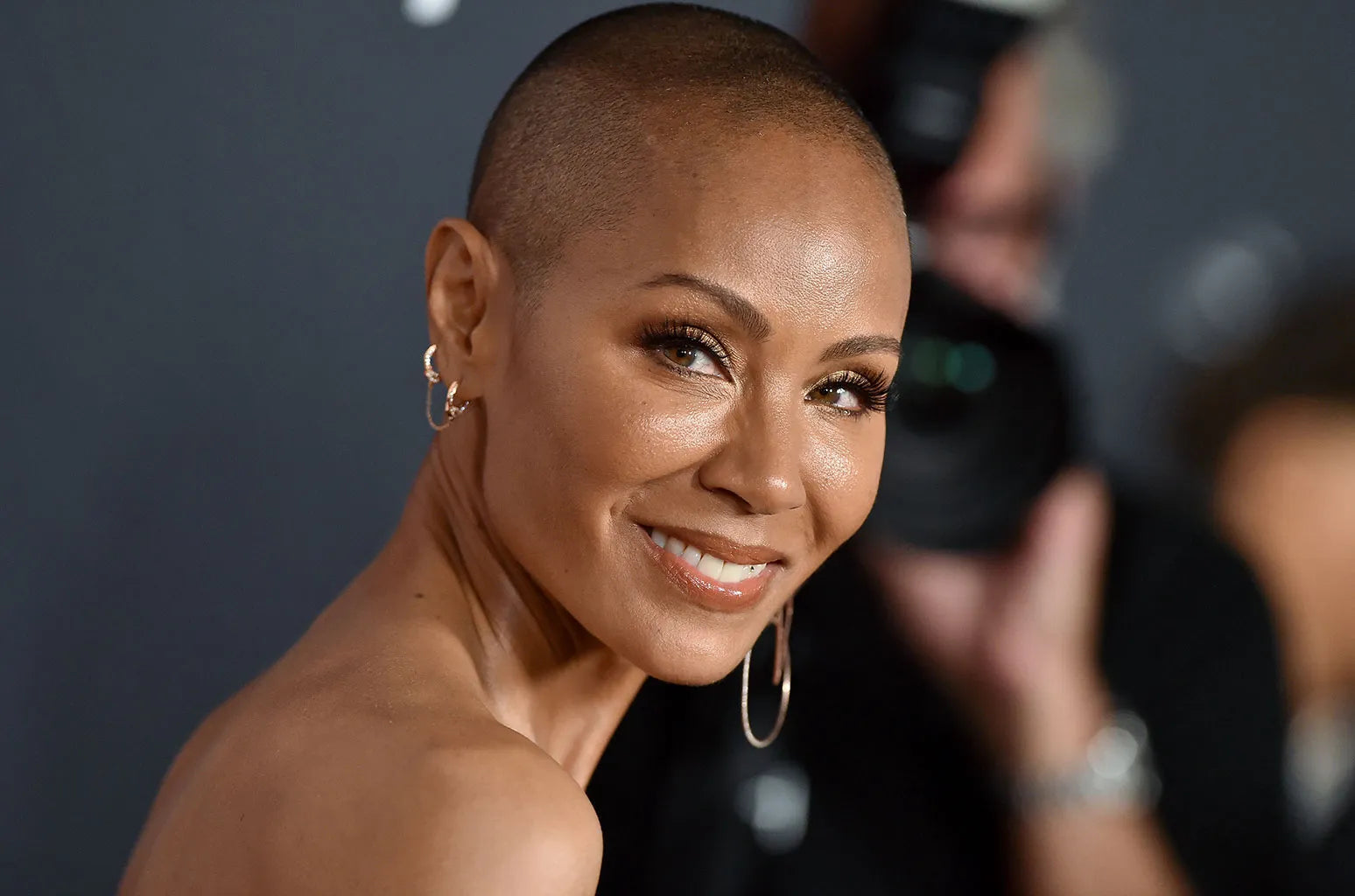 Jada Pinkett Smith and The Emotional Implications of Alopecia - MyHairSmart