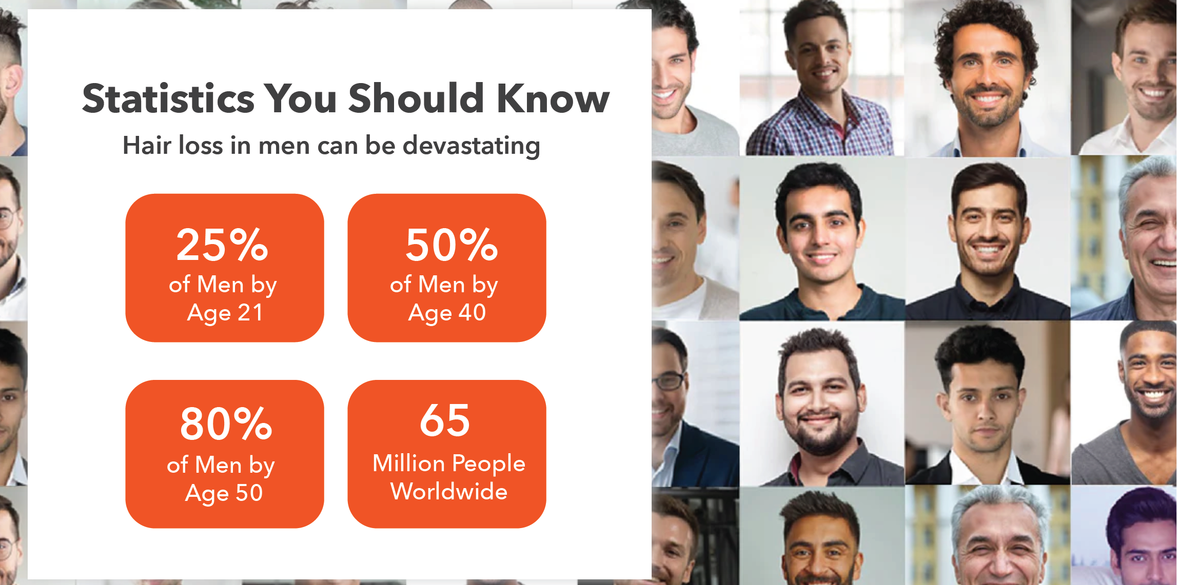 Hair loss men statics with hairsmart