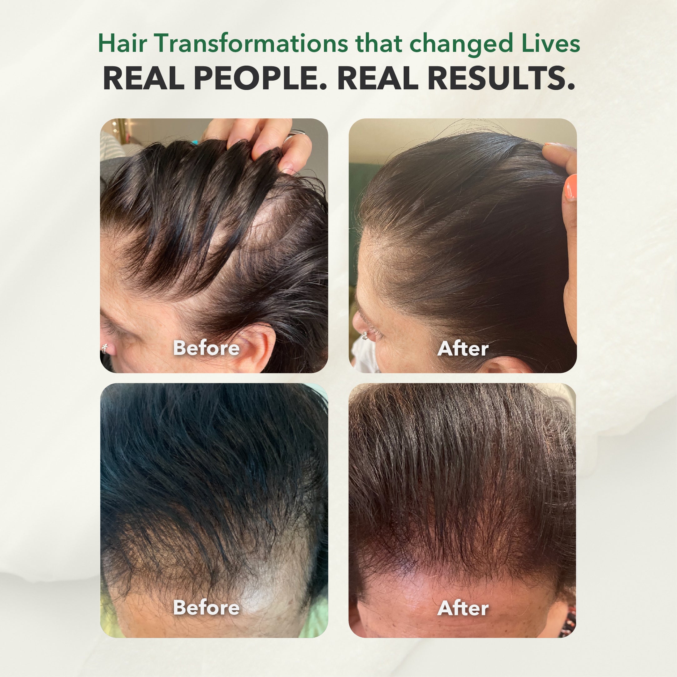 Pro for Women: Clinically Advanced 4-Step System for Hair Regrowth & Strength