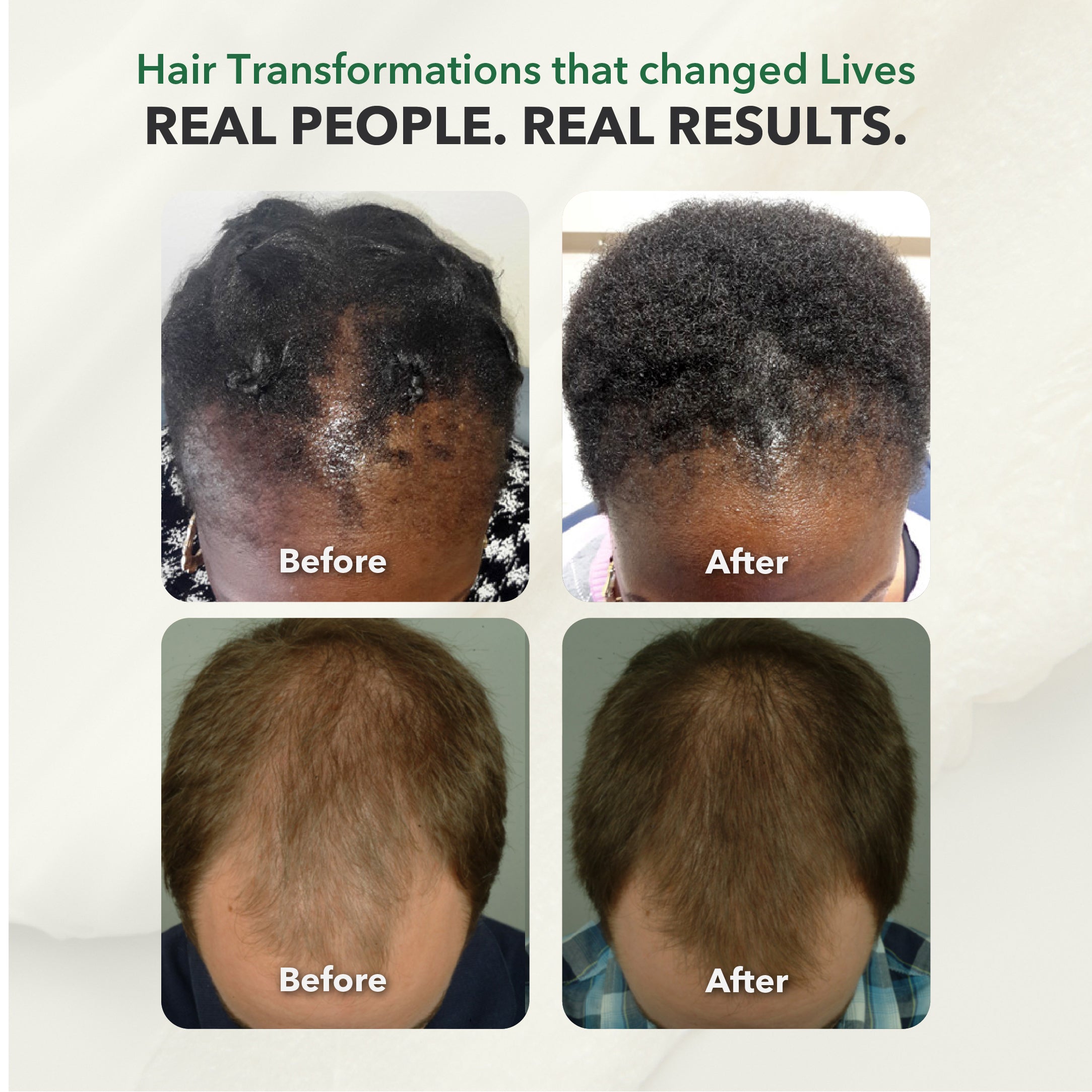 Rosemary Bhringraj Amla Ayurvedic Hair Growth Oil – 100ml