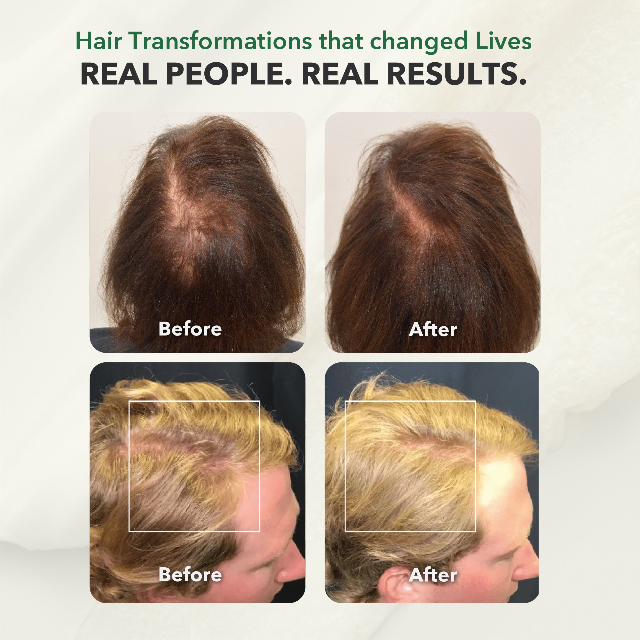 HairSmart RSH Therapy Shampoo: Ayurvedic Gentle Cleanser, 300 ml