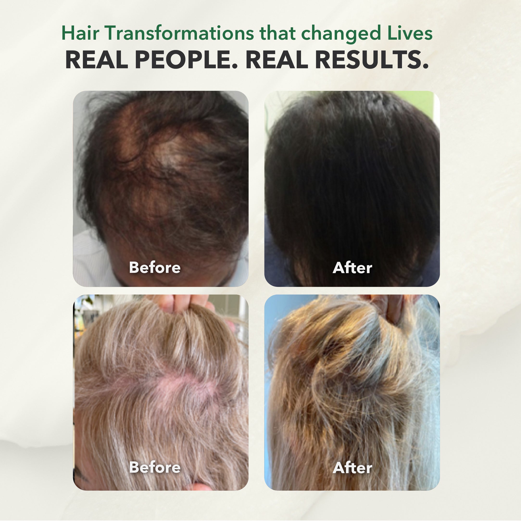 Restorative Conditioner: Premium Ayurvedic Moisturizing Formula; 300 ml