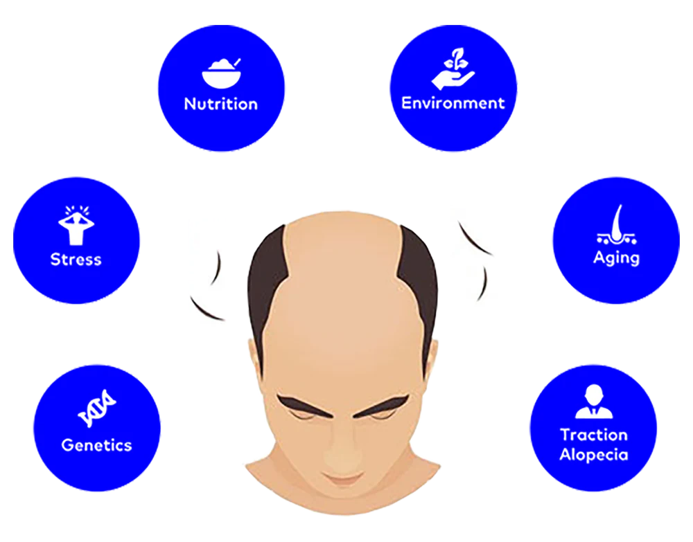Why do Men Lose Their Hair in the First Place?
