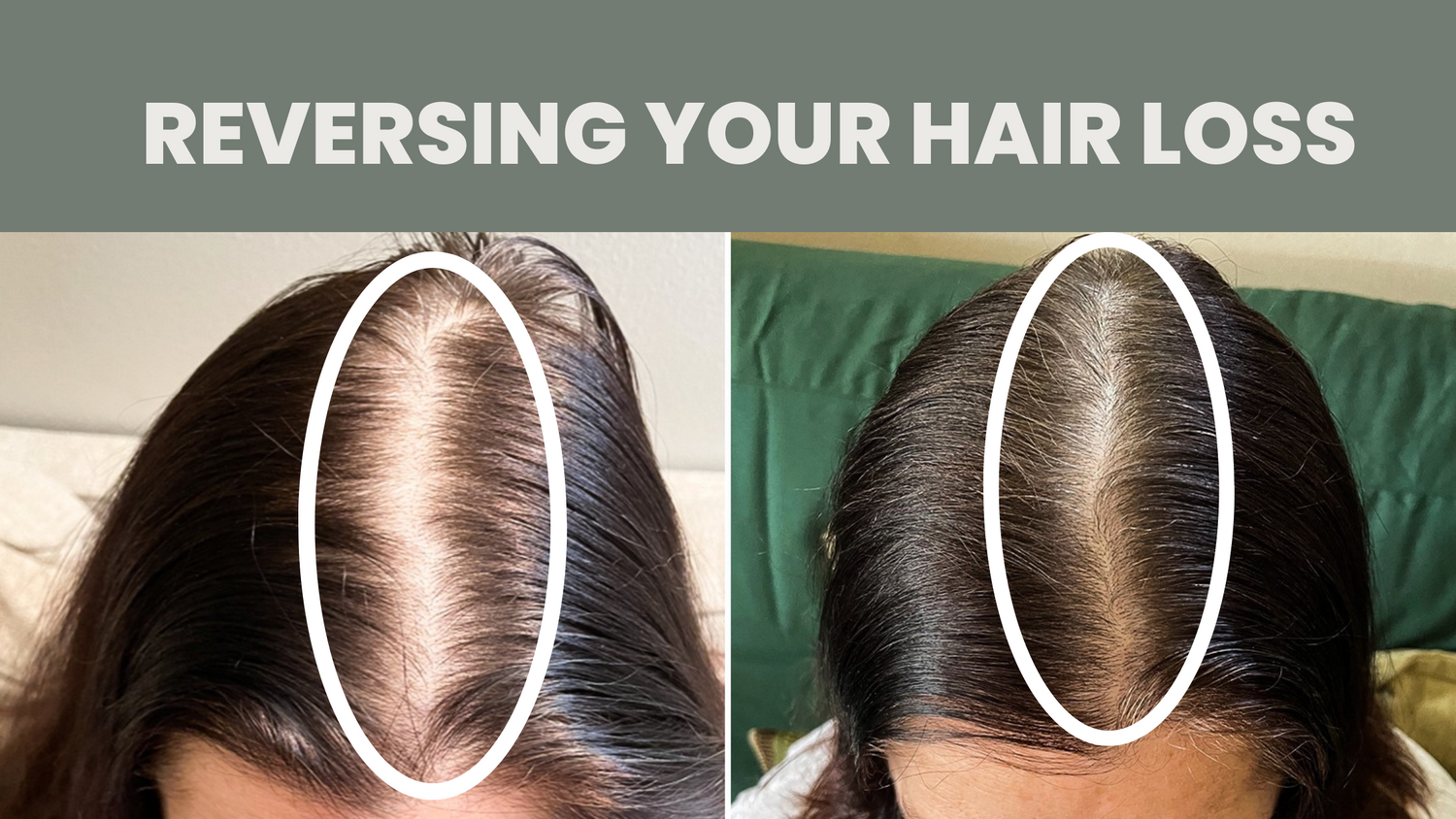 Unlocking Hair Growth: 3 Critical Steps for Successful Regrowth