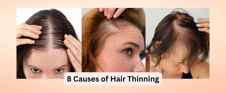 8 Causes of Hair Thinning in Women Over 40 (And How to Fix It)