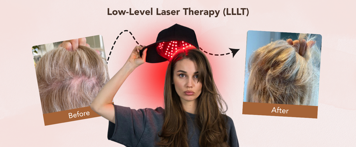 Low-Level Laser Therapy (LLLT)