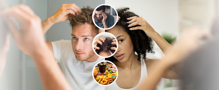 6 Everyday Habits That Are Secretly Making You Bald