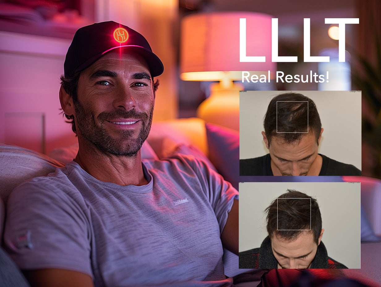 Harnessing the Power of LLLT for Hair Regrowth: A Closer Look
