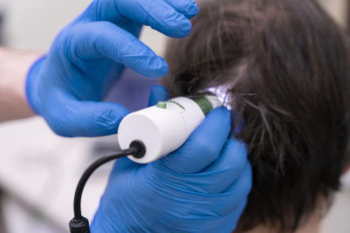 Laser Hair Therapy Caps: A Non-Invasive Approach to Combat Hair Loss