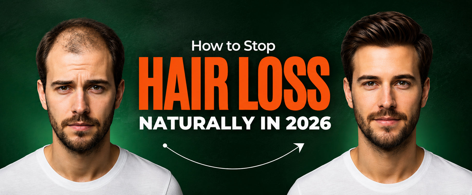 HairSmart Laser Cap