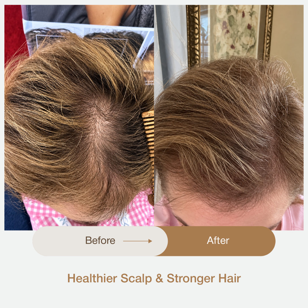 AYURVEDIC HAIR & SCALP SPA EXPERIENCE