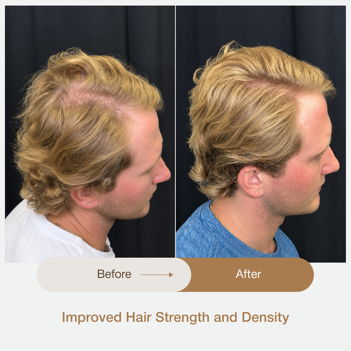 AYURVEDIC HAIR & SCALP SPA EXPERIENCE